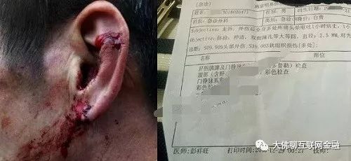 _p2p理财付融宝跑路_ 付融宝网贷平台逾期事件 